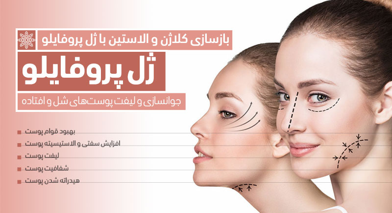 لیست بهترین مراکز تزریق ژل پروفایلو و جوانسازی