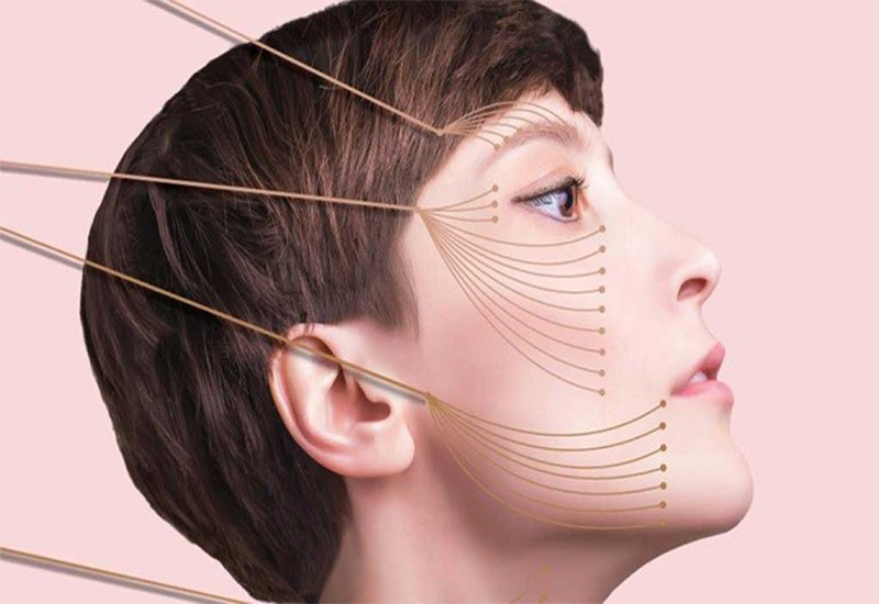 ماندگاری لیفت صورت با نخ