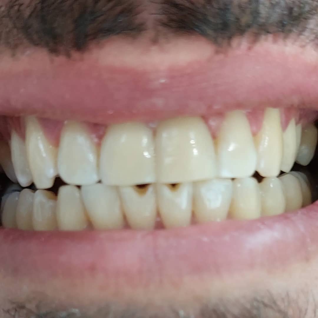 WhatsApp-Image-2024-04-16-at-09.23.04