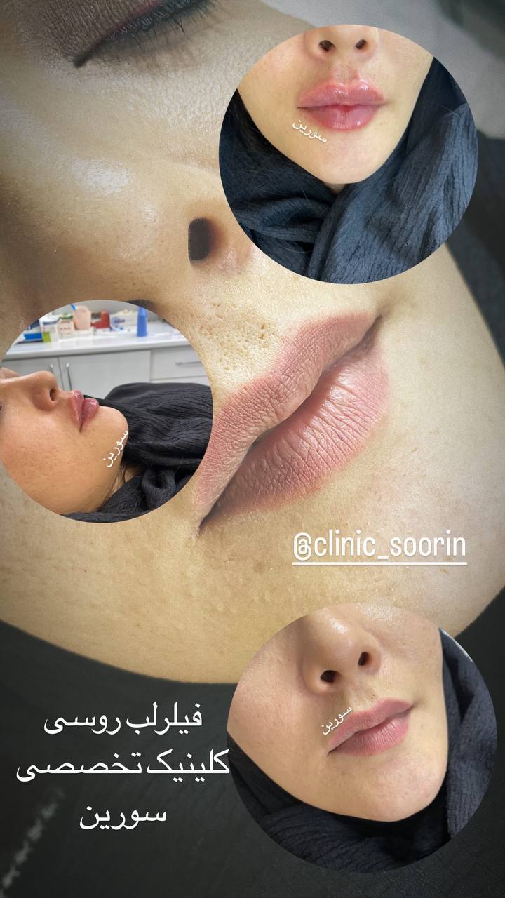 ۸۸۱adee9-130b-4bb4-9693-cce19e654dbf