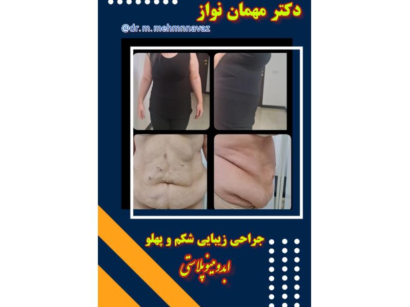 ۹۴edb9c47a4948288122e06bd1eeb0c2