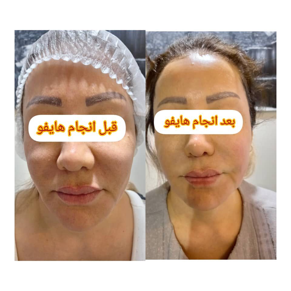 WhatsApp-Image-2024-04-15-at-14.32.37