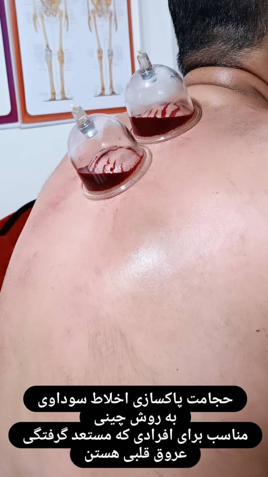 WhatsApp-Image-2024-05-12-at-18.35.43