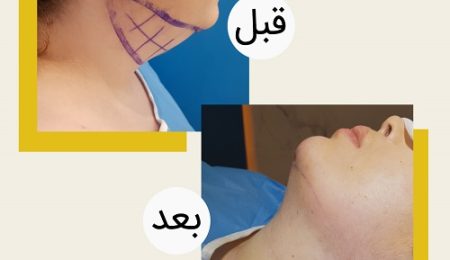 _هزینه،مزایاومعایب