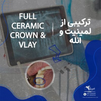 ۴۱۳۹۵۴۰۸۳_۱۵۱۰۶۴۹۸۱۳۱۲۴۸۶۴_۷۰۸۵۷۰۹۴۹۰۲۷۳۶۴۴۳۳_n