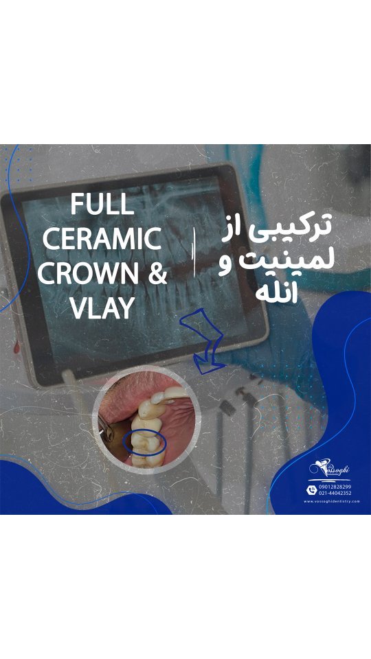 ۴۱۳۹۵۴۰۸۳_۱۵۱۰۶۴۹۸۱۳۱۲۴۸۶۴_۷۰۸۵۷۰۹۴۹۰۲۷۳۶۴۴۳۳_n