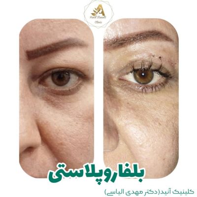 WhatsApp-Image-2024-06-10-at-18.07.55