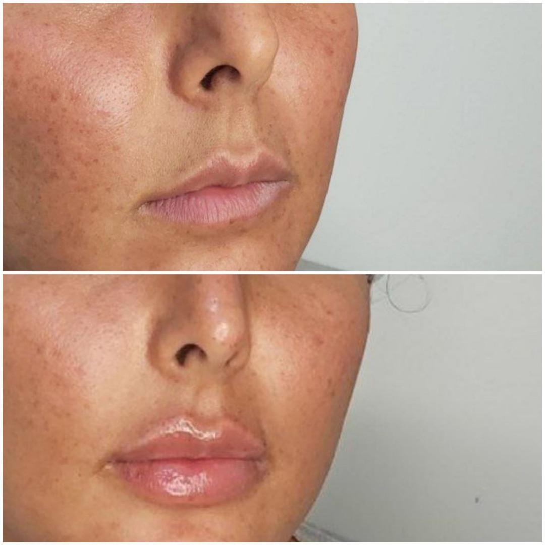 d3aded59-8dfb-4dad-a14b-cf664c01d966