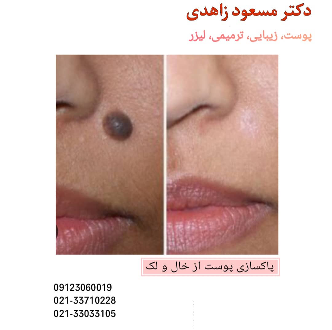 ۰۷۸۵a055-f6e4-4d1c-b556-82045cc2aca1