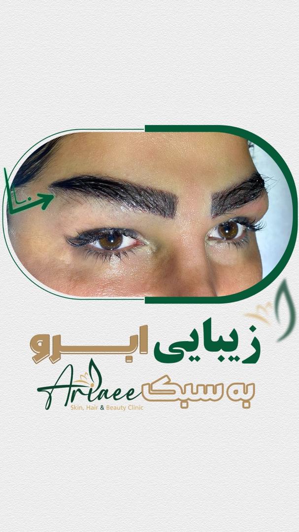 ۲۱۸d7d6d-c8ca-44e1-9b0d-06e8a708bb81