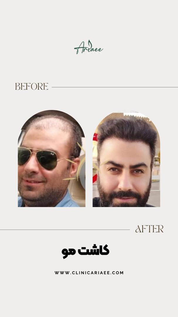 b11bb9b3-192a-49b4-b027-6d95c4ce7c11