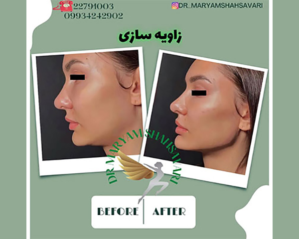 ۲۲۲۲-۱