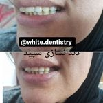 ۲۷۷۸۲۲۱۹۹_۲۳۴۲۵۵۱۰۲۲۱۶۱۴۹_۱۵۳۴۷۸۲۵۶۰۳۷۲۷۵۰۶۹_n