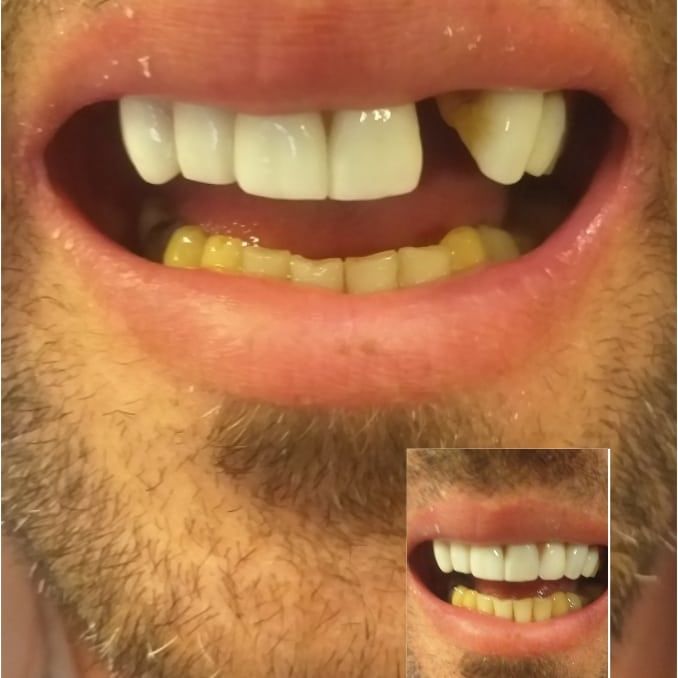 photo_5904628396552472169_x