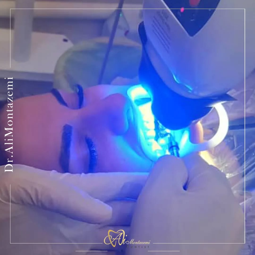 ۵۹۵۷۲۲۲۰۶۶۳۸۸۳۱۷۶۵۵