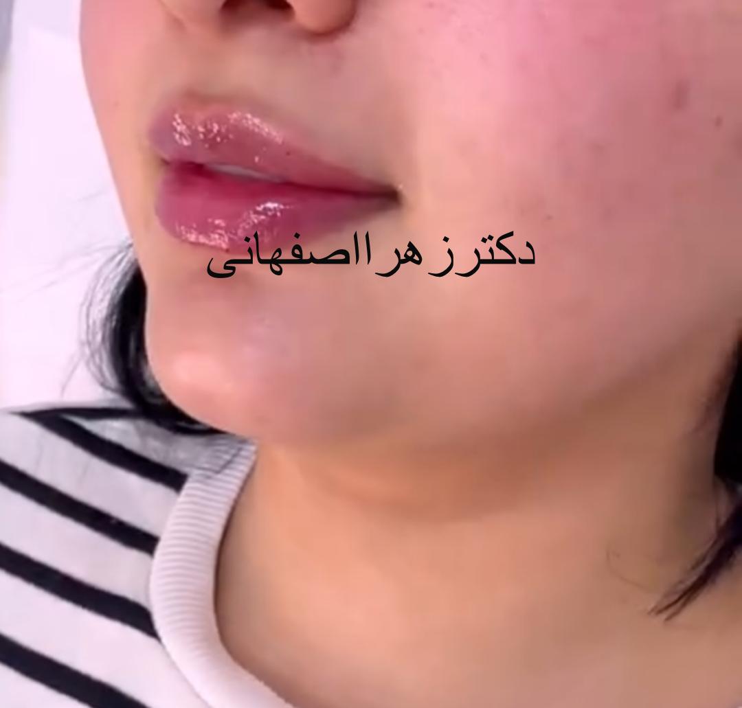 WhatsApp_Image_2024-10-26_at_11.55.38_AM