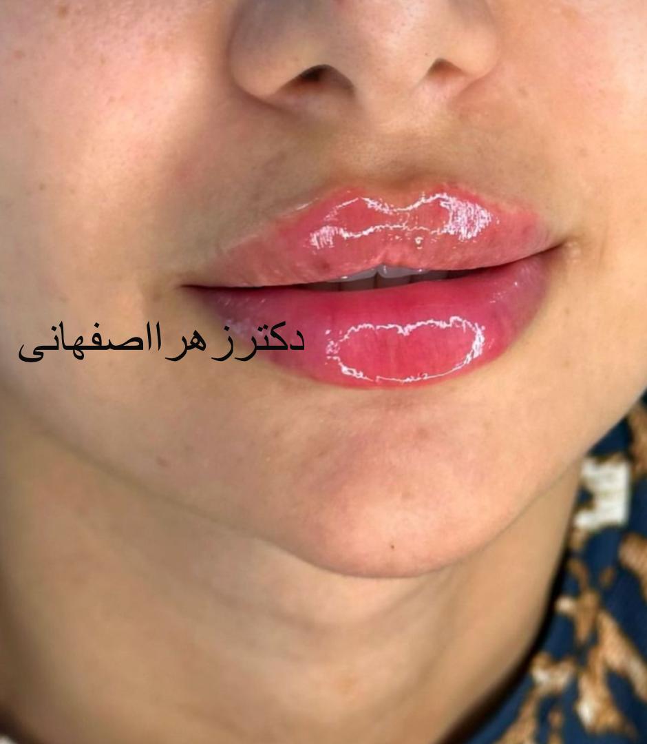 WhatsApp_Image_2024-10-26_at_11.56.08_AM