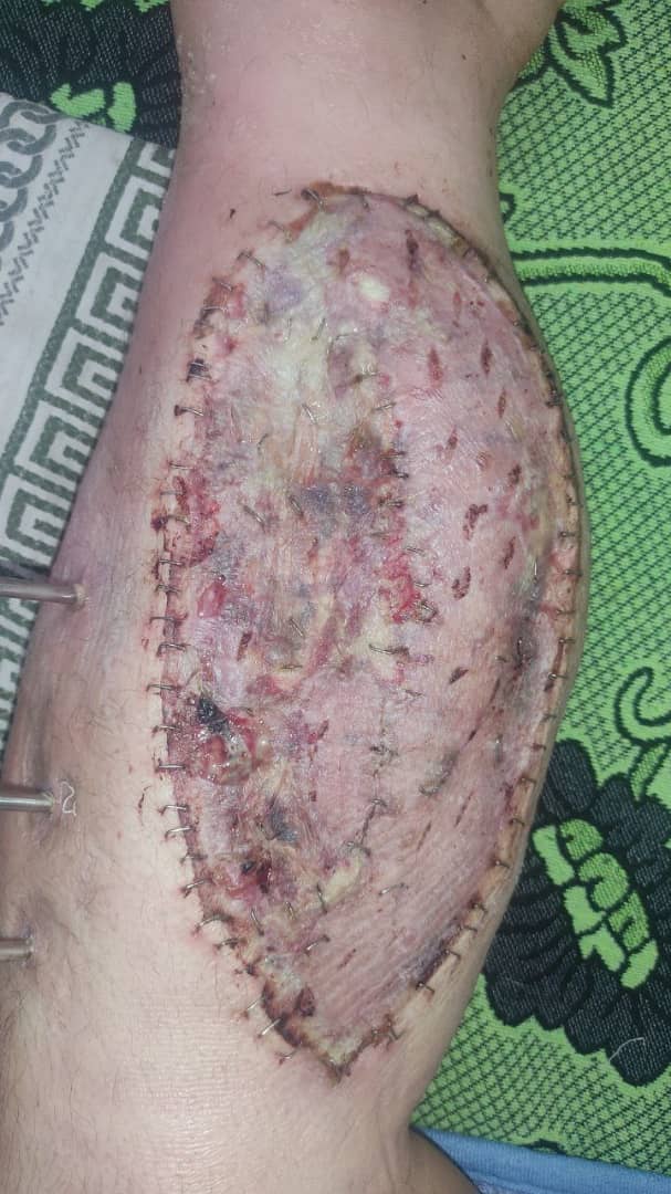 WhatsApp-Image-2025-03-08-at-10.30.42-AM-3