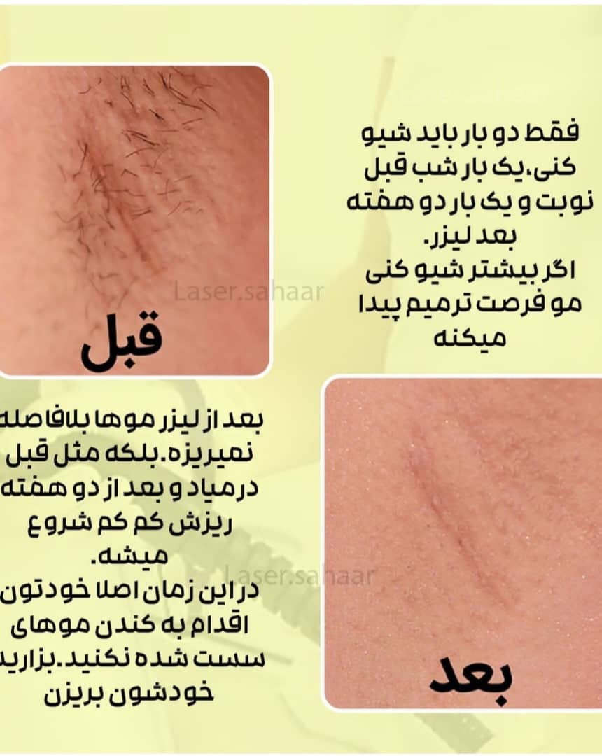 WhatsApp-Image-2025-03-09-at-12.17.12