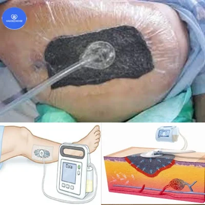 ۱۰۰۰۰۴۳۳۲۲