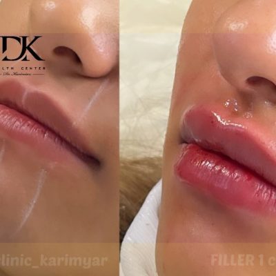 ۲۸۳۱۰۰۶۶۱_۶۹۹۳۷۷۱۲۴۶۱۸۹۵۲_۶۸۹۱۱۷۲۵۴۵۱۶۱۷۸۹۷۷۴_n