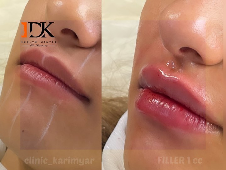 ۲۸۳۱۰۰۶۶۱_۶۹۹۳۷۷۱۲۴۶۱۸۹۵۲_۶۸۹۱۱۷۲۵۴۵۱۶۱۷۸۹۷۷۴_n