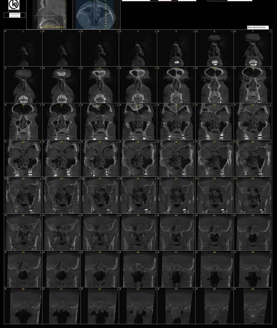 ۹۱۱c84de-0b90-4f76-a9d4-e924e15477f5