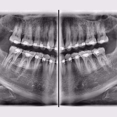 What-is-maxillofacial-radiology