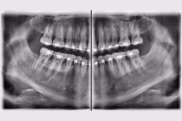 What-is-maxillofacial-radiology