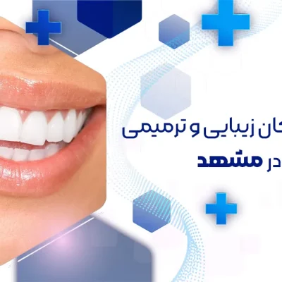 cosmetic-dentists-in-mashhad