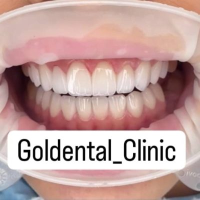 ۸۹۳۲۶۴۰۲-DB4F-4E03-88AD-87AE7E121B30