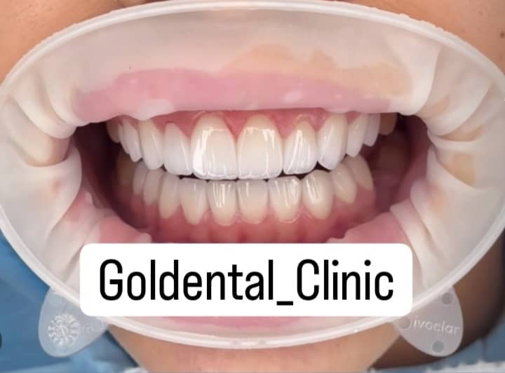 ۸۹۳۲۶۴۰۲-DB4F-4E03-88AD-87AE7E121B30