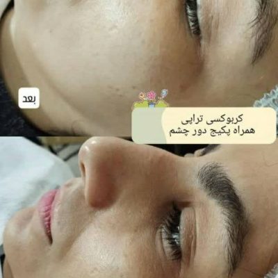 IMG_20260131_084851_298