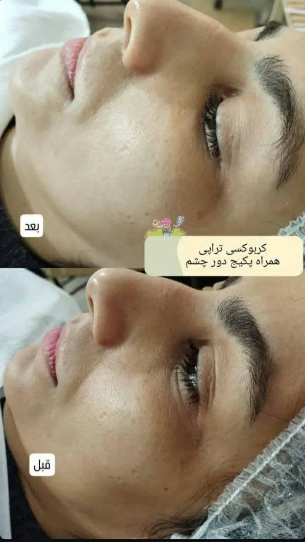 IMG_20260131_084851_298